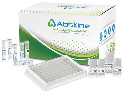 https://d1vffmuvmgkypt.cloudfront.net/image/ridacom_ltd/abbkine_scientific_co_ltd/PRODUCT_SOURCE__ABBKINE__SUPPLIER__RIDACOM__ID__KTE62414__1